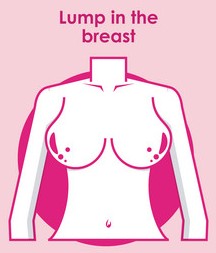 lump-in-breast